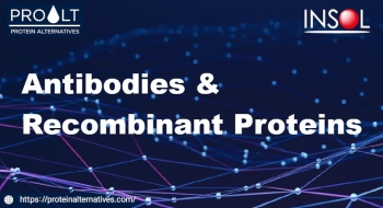 ProAlt ��ü & ������ �ܹ���